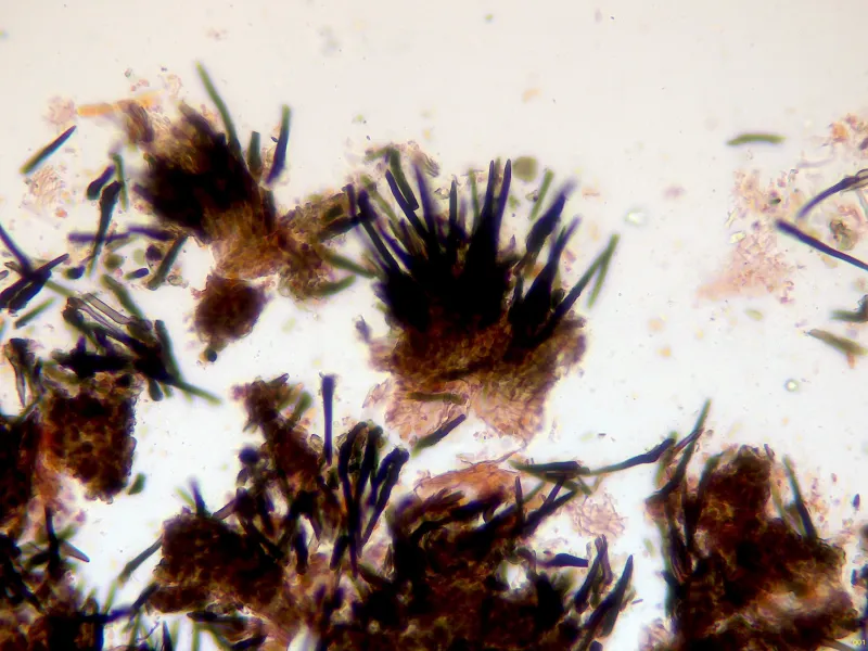 Coniochaeta malacotricha 13 - Pelos x 400-001